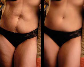 retouch